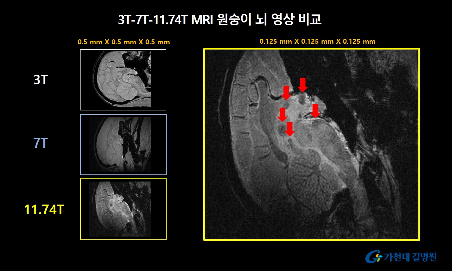 세계 최초 11.74T MRI 이용 원숭이 뇌영상 획득 성공