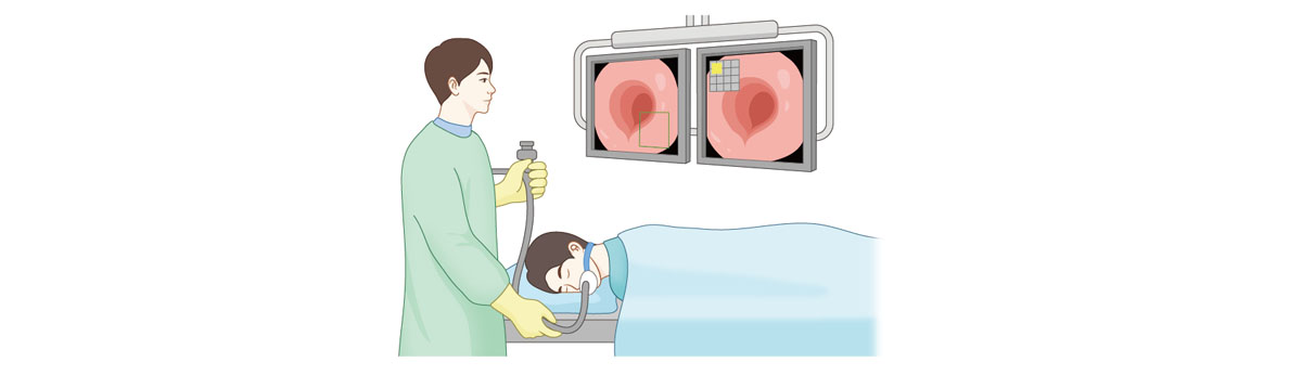 Endoscopic Examination