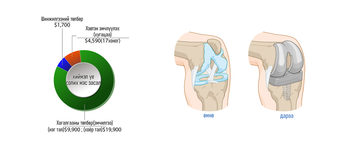 өвдөгний үе